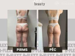 Skulpturējošā masāža B - MM.LV